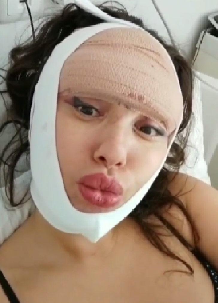 10 yılda 22 kez estetik ameliyat oldu! G5