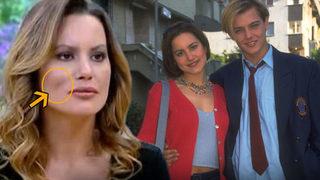 Yıldız Asyalı'nın yüzüne ne oldu? 'Kazadan sonra...'