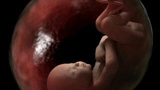 Kürtaj oranlarının doğum oranını geçtiği ülke: Grönland