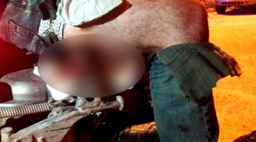 İzmir'de doktorları şoke eden olay! Motosikletin ayaklığı bacağına saplandı 