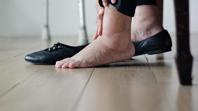 Diyabetik ayak tedavisinde minimal invaziv cerrahi yöntemleri