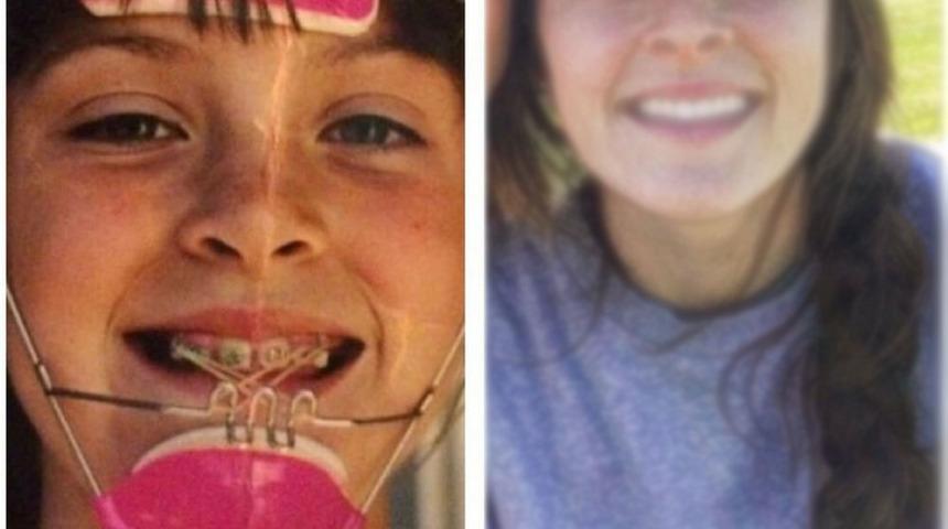 Ergen hallerine bakıp aldanmayın! Şimdi bambaşka insanlar