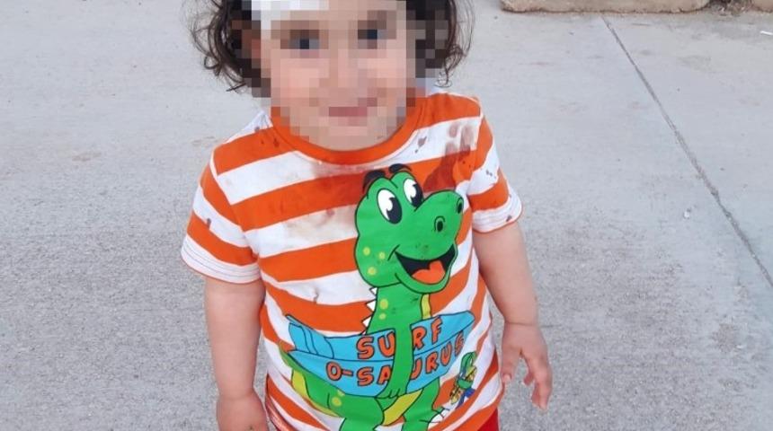 Sokak k&ouml;peği 1,5 yaşındaki &ccedil;ocuğa saldırdı