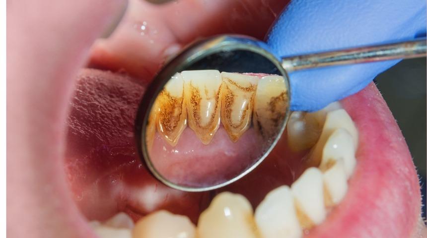 Sahurda ve iftarda şekerli gıdalar tüketmeyin