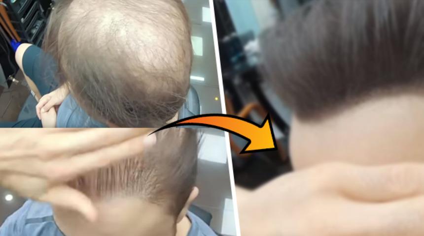 Kel g&ouml;r&uuml;nt&uuml;s&uuml;nden d&uuml;ğ&uuml;n i&ccedil;in kurtulmak istedi! Son hali ise şoke ediyor