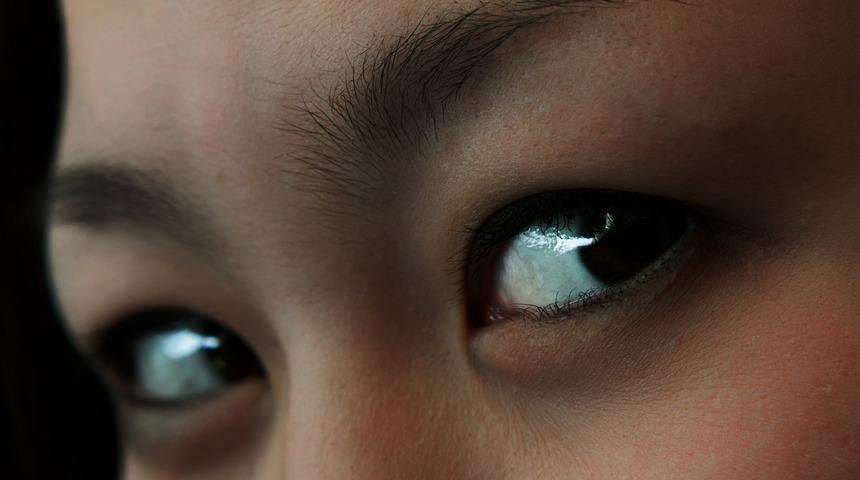 Kaş d&ouml;k&uuml;lmesi y&uuml;z ifadesini etkiliyor