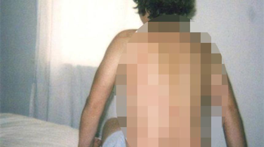 Yıldırım çarpmasına maruz kalmış insanlar!