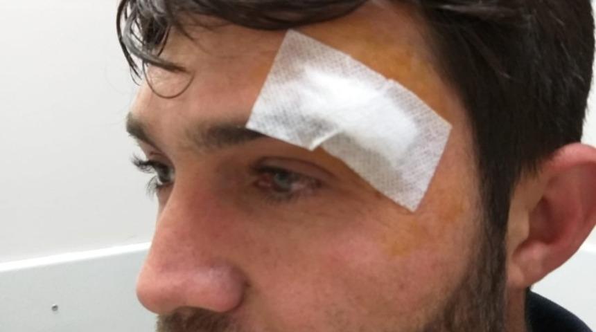 Ambulans s&uuml;r&uuml;c&uuml;s&uuml; darp edildi