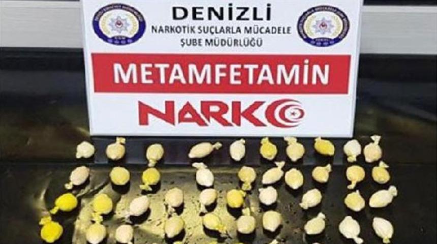 R&ouml;ntgen filminde tespit edildi! Mide ve bağırsaklarından &ccedil;ıktı