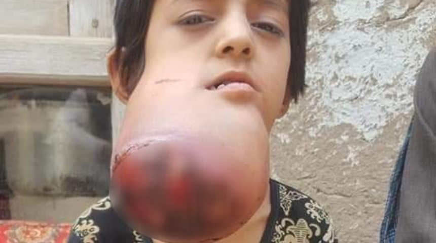 Doktorlar bu hastalığı teşhis edemiyor!