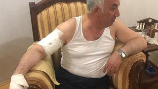 Arpaçay Belediye Başkanı'na köpek saldırdı