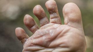 Yaz geliyor, mantara dikkat!