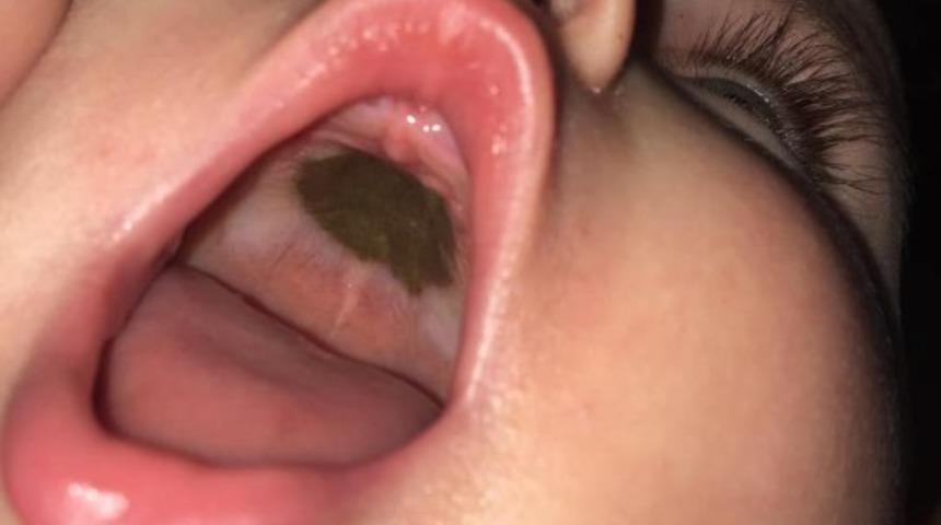 Bebeğinin ağzındaki leke için doktora götürdü, gerçeği öğrenince şaşkına döndü