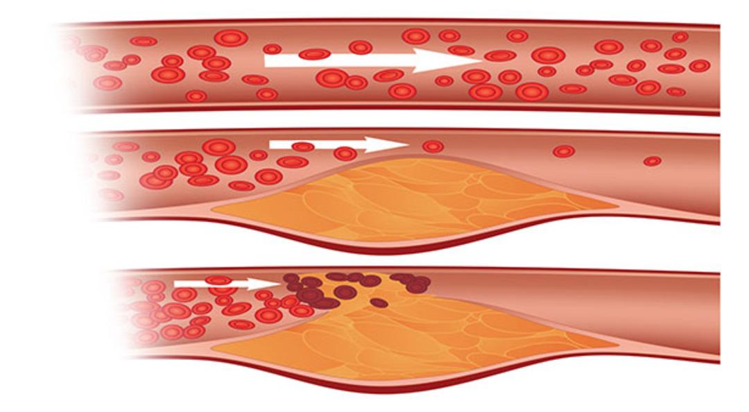 Kolesterol&uuml;n&uuml;z&uuml; D&uuml;ş&uuml;rmenize Yardımcı Olacak 6 S&uuml;per Yiyecek 
