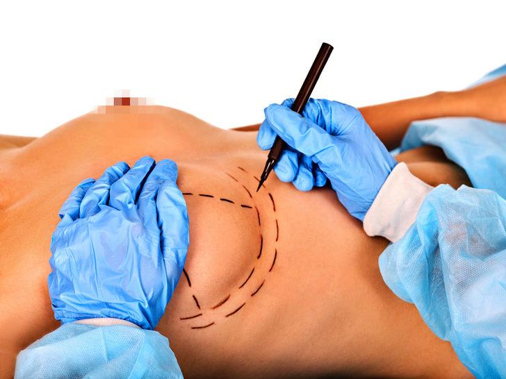 Merdiven altı estetik ameliyatlarda karşılaşılan en yaygın 10 hata G1