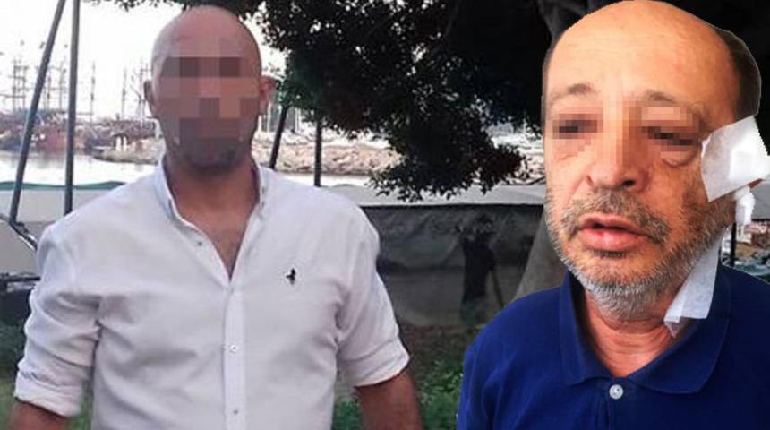 Antalya'da korkunç olay! Eski ev arkadaşının kulağını kesti