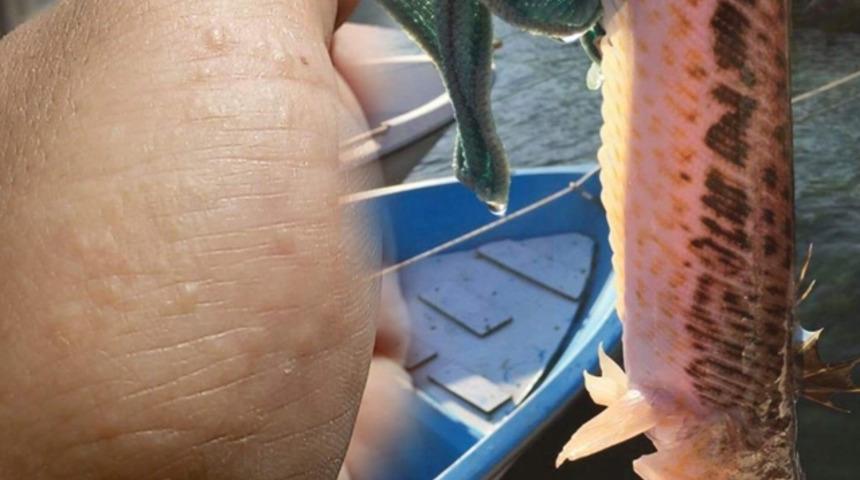 Olta balıkçılarına trakonya uyarısı! İki kişiyi zehirledi