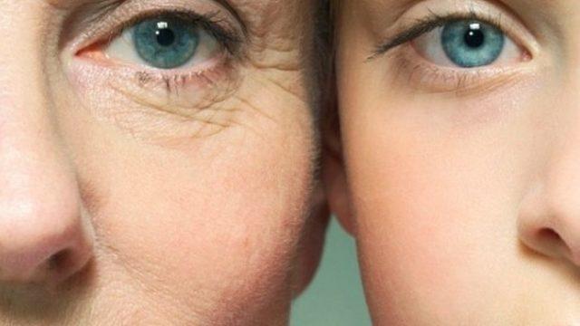 Dermal dolgular ile gençleşin