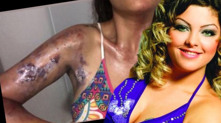 Gelin adayı Sinem Umaş'ın evinde d&uuml;d&uuml;kl&uuml; tencere patladı! &Ouml;l&uuml;mden d&ouml;nd&uuml;