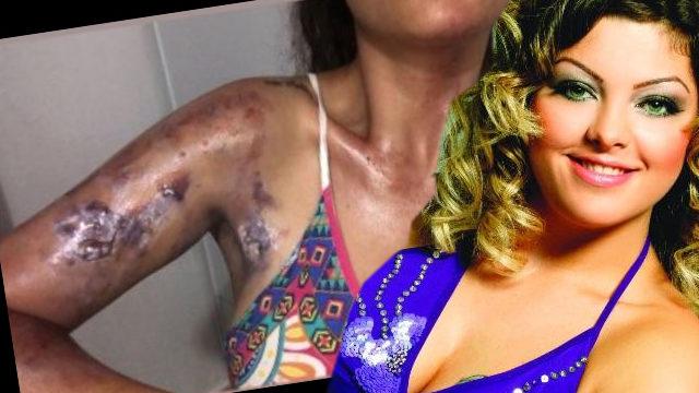 Gelin adayı Sinem Umaş'ın evinde düdüklü tencere patladı! Ölümden döndü