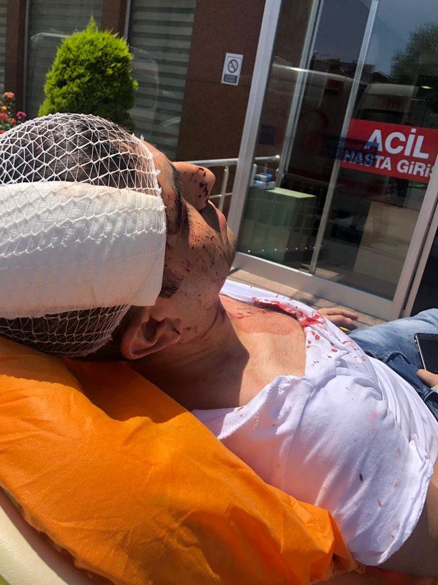 Akit TV Haber Müdürü Murat Alan saldırıya uğradı