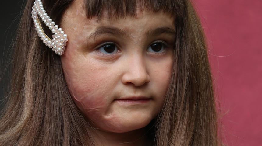 Zeynep'in 'peruk' hayali ger&ccedil;ek oldu