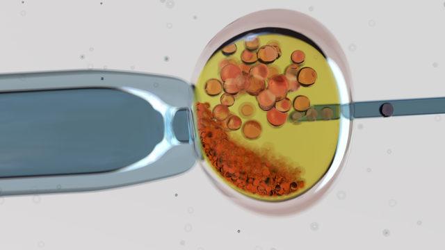 'Tüp bebek tedavisine başlamadan kilo verilmeli'