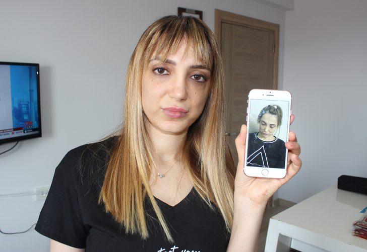 Estetik yüzünden tanınmaz hale geldi! G2