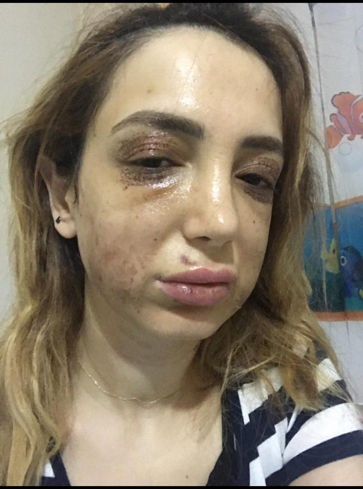 Estetik yüzünden tanınmaz hale geldi! G4