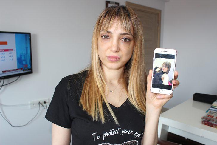 Estetik yüzünden tanınmaz hale geldi! G3