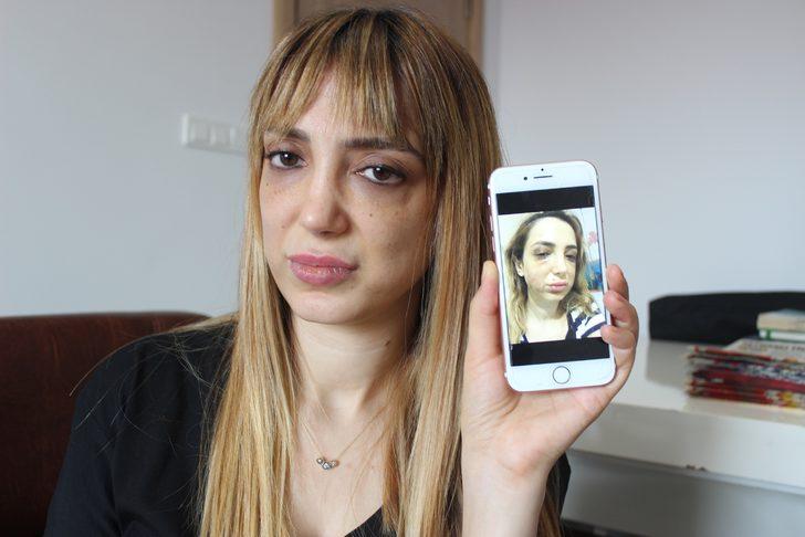 Estetik yüzünden tanınmaz hale geldi! G5