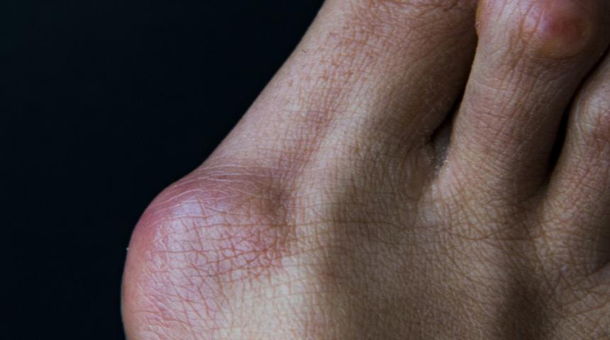 Rahat olduğu için tercih ediyoruz ama babet ayakkabılar ayak sağlığını bozuyor