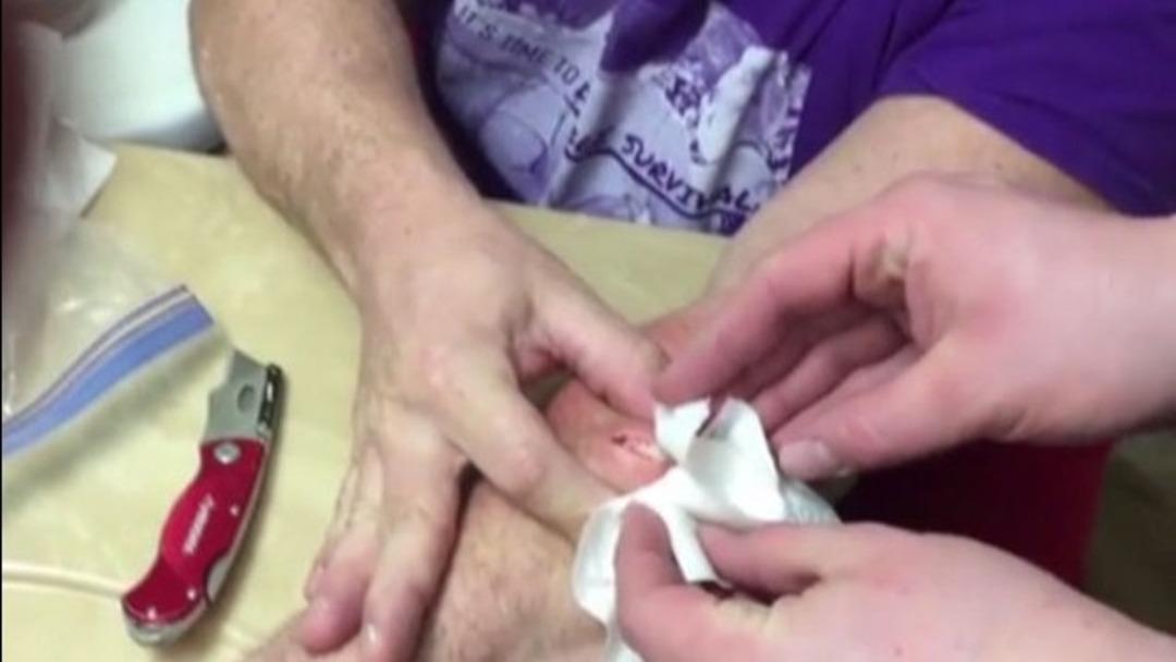 Bu g&ouml;r&uuml;nt&uuml;leri mideniz kaldırmayabilir! 