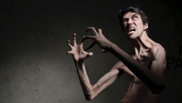 marfan-syndrome-horror-movie-actor-javier-botet-11-5cee3ee68aa2c__700-600x338