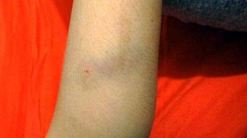 Fatsa&rsquo;da k&ouml;peğin saldırısına uğrayan &ccedil;ocuk yaralandı