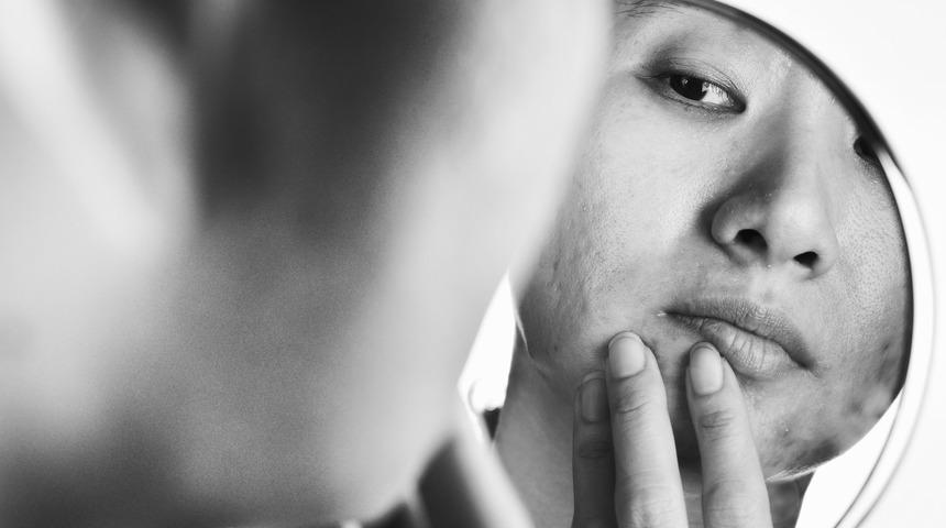 Yorgun y&uuml;z g&ouml;r&uuml;nt&uuml;s&uuml;ne dikkat! Kadınlar en &ccedil;ok  kuruluk, morluk ve koyuluktan şikayet ediyor