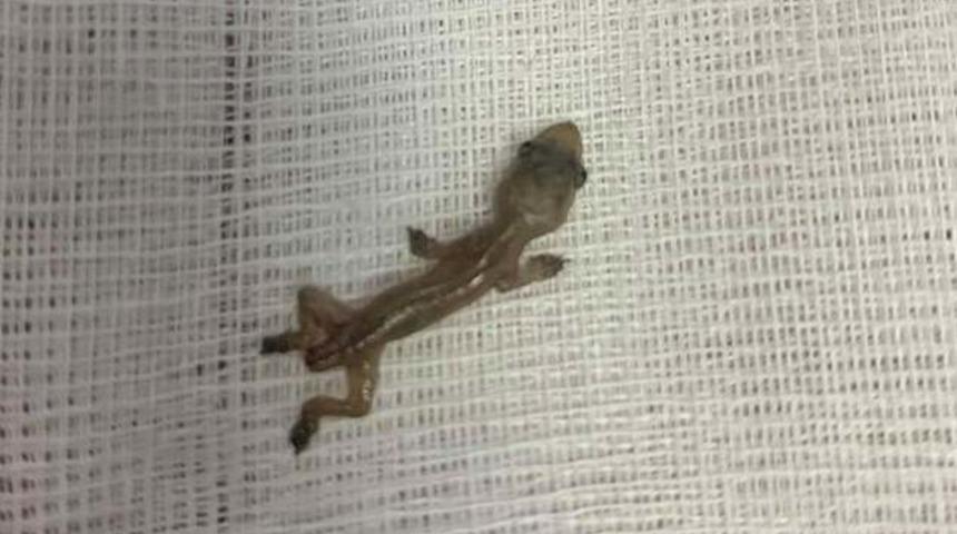 Ağrıyla doktora gitti! Kulağından öyle bir şey çıktı ki...