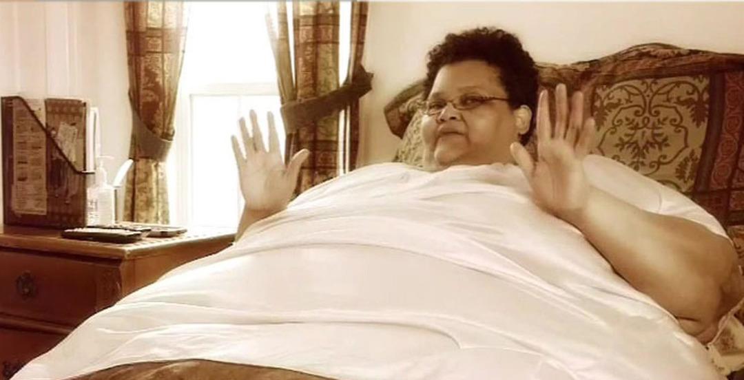 340 kiloya kadar &ccedil;ıkmıştı! Son halini g&ouml;renler 'Bu mucize' diyor!