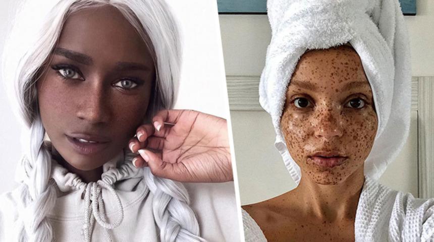 Moda dünyasının güzellik anlayışını yeniden yazan sıra dışı modeller!