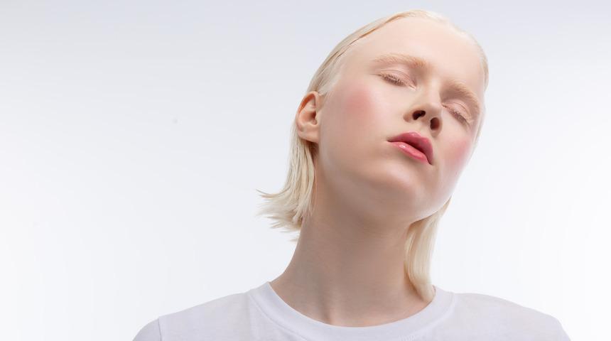 Beyaz melek albinolar ve görme kusurları