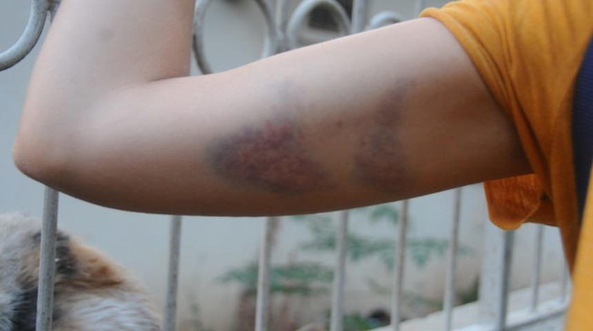 Adana'da kedileri besleyen genç kız darp edildi