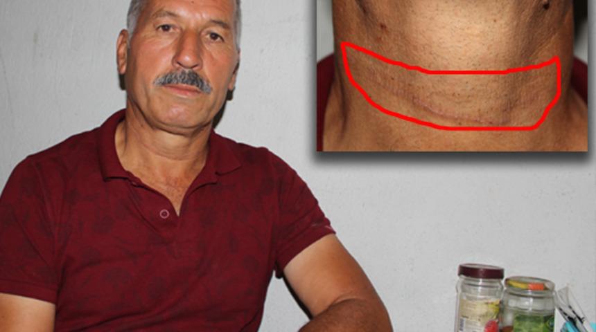 Muğla'da patronlarını domuz bağıyla bağlayıp işkence yaptılar