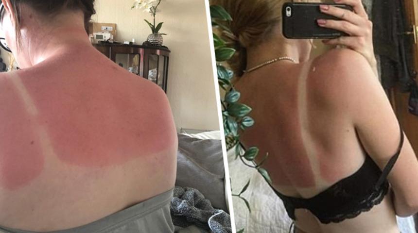 Sıcak hava onları da vurdu! Cayır cayır yandılar