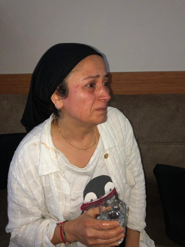 Hayvansever kadından, Sokaklarda köpekleri besliyorum diye dövdüler iddiası 1