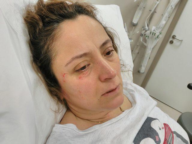 Hayvansever kadından, Sokaklarda köpekleri besliyorum diye dövdüler iddiası 3