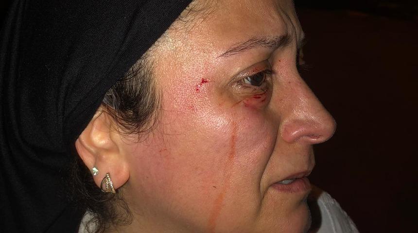 Hayvansever kadından, 'Sokaklarda k&ouml;pekleri besliyorum diye d&ouml;vd&uuml;ler' iddiası