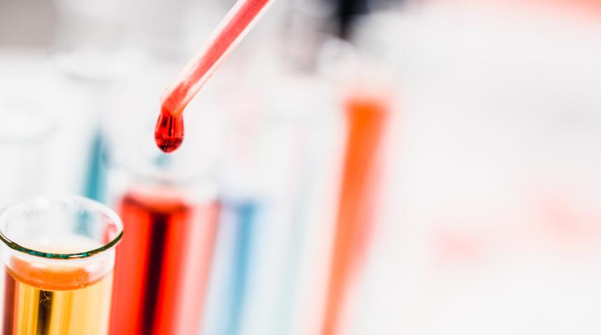 AIDS tedavisi mümkün mü? Yeni araştırma umut ışığı oldu