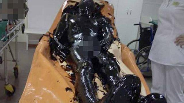 Zehirli katran çukuruna düştü ancak bir mucize yaşandı!