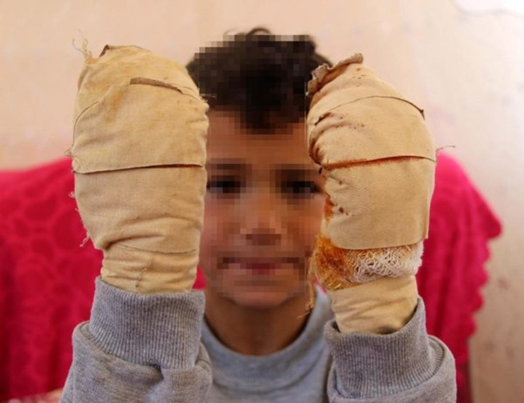 Komşu &ccedil;ocuğu k&uuml;&ccedil;&uuml;k Efe'ye dehşeti yaşattı! Ağlama seslerini duyan komşular yardıma koştu