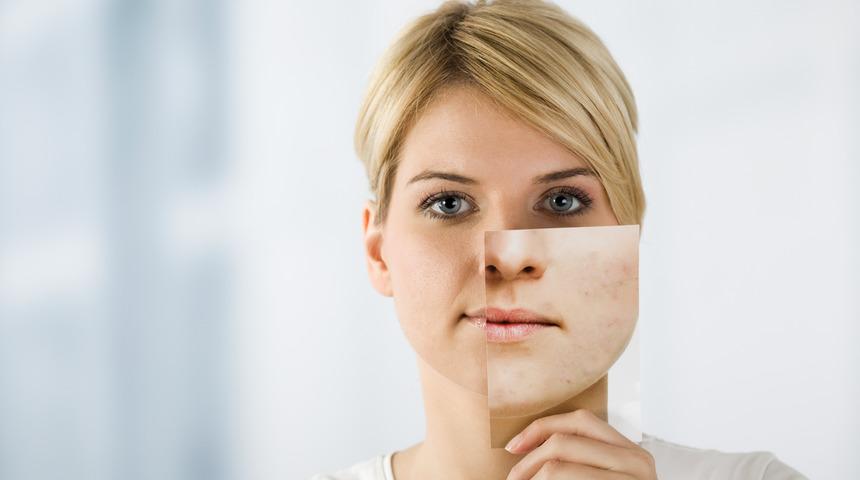 40 yaş sonrası cilt problemlerine dikkat 